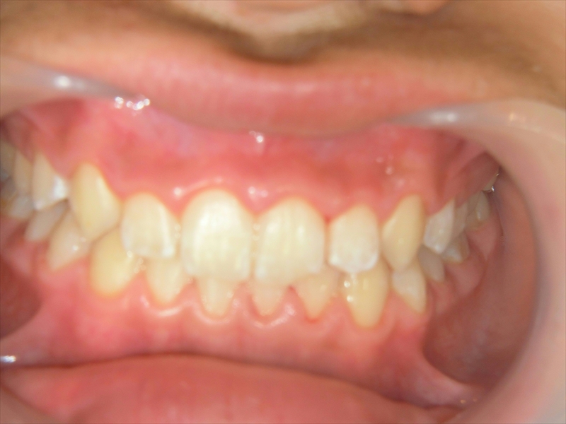 After image