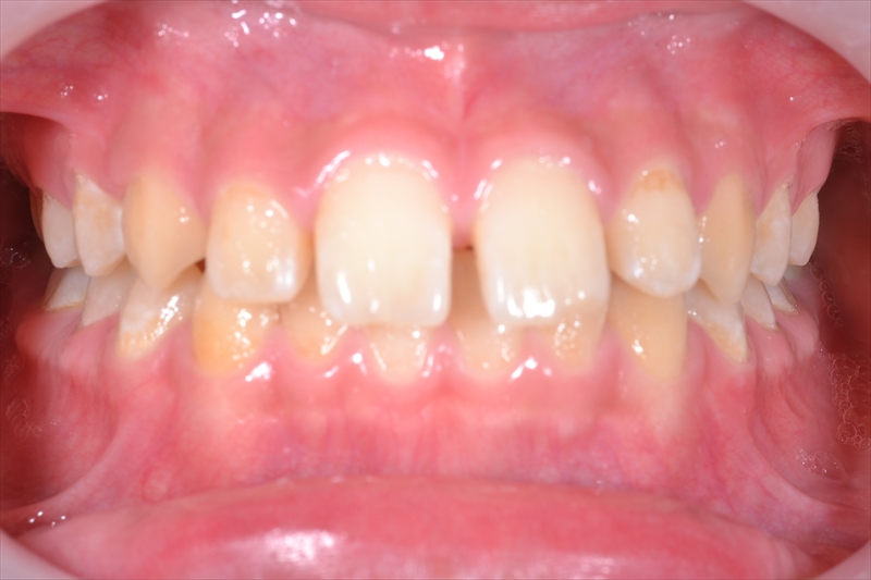 Before image