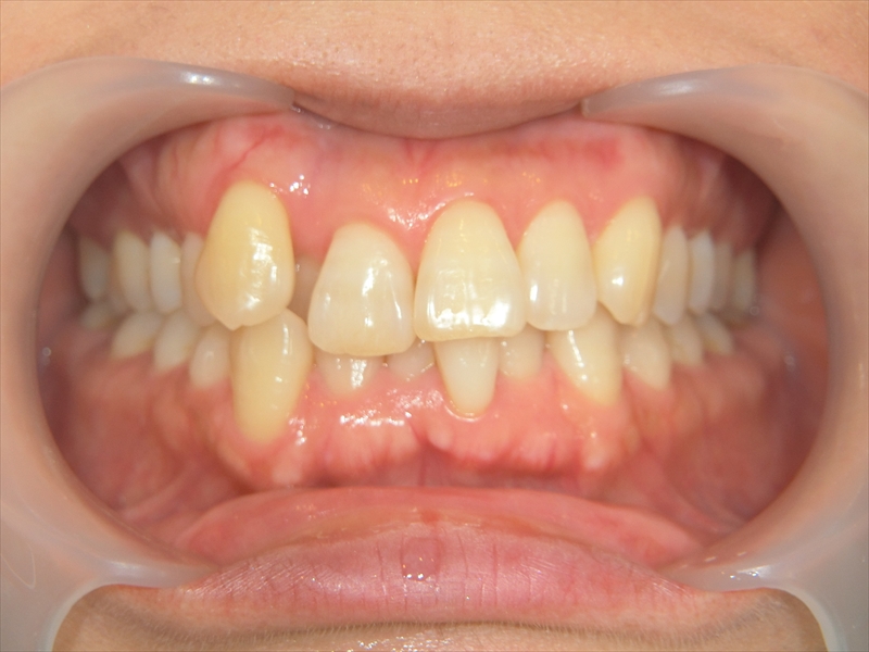 Before image