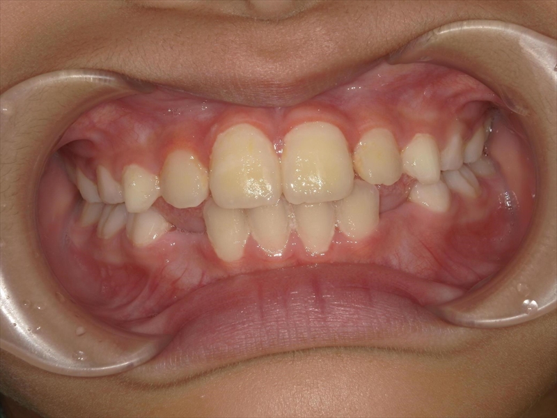 After image
