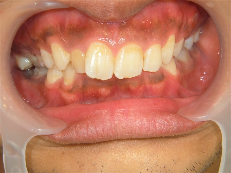 Before image