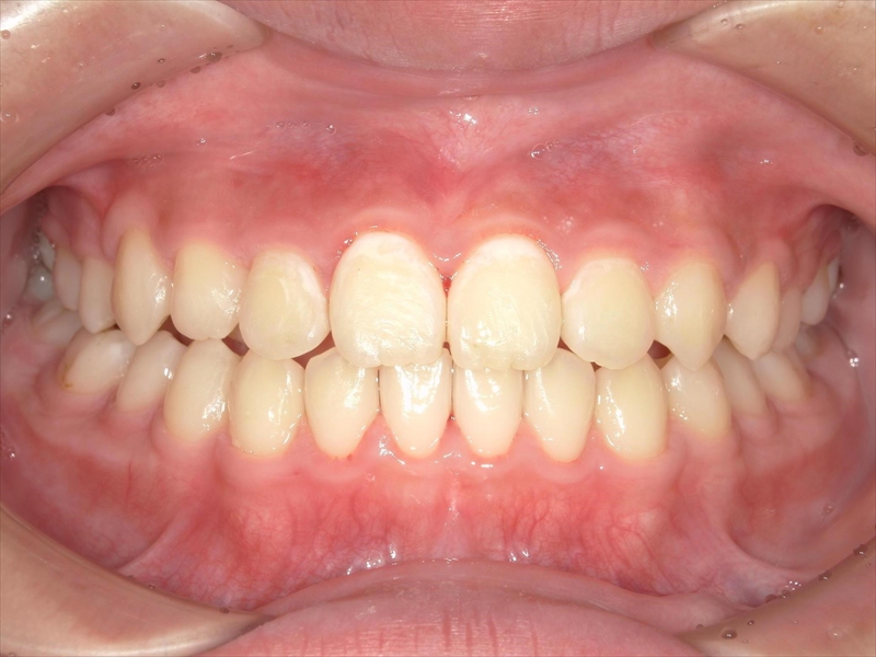 After image