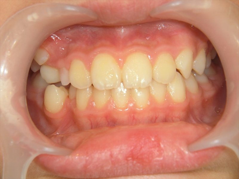 Before image
