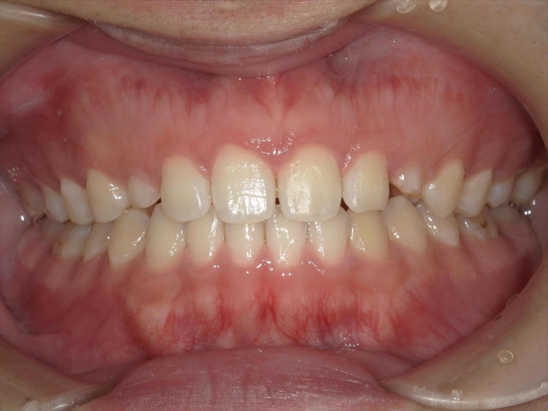 After image
