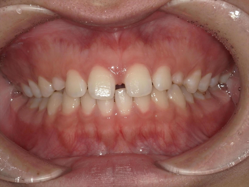 Before image