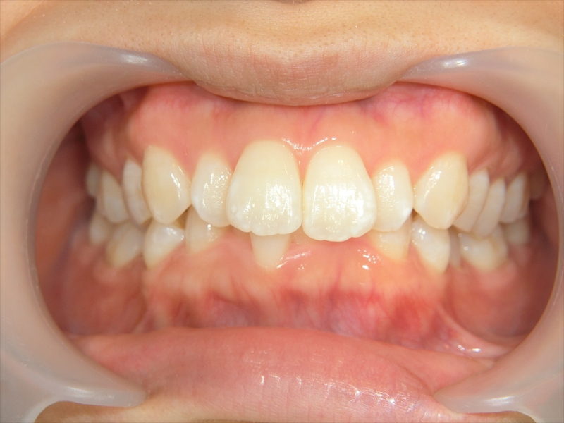 Before image