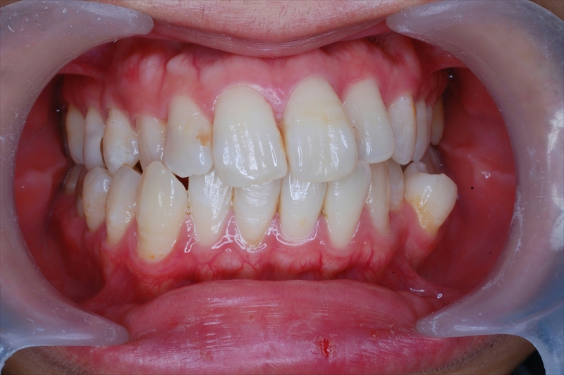 Before image