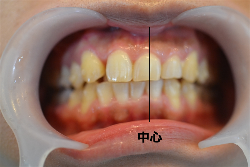 中心からズレていると分かる画像